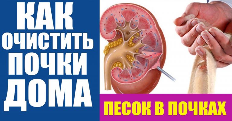 Почки должны быть здоровы. Старый рецепт — удаляет песок, растворяет камни и лечит цистит