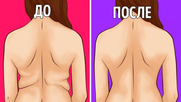 Убери складки на спине и боках при помощи 4 простых упражнений: красивый изгиб уже за 3 недели