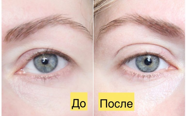 Убираем нависшие веки. Мощный рецепт проверенный временем