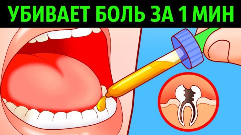 Вот как снять любую зубную боль всего за несколько секунд