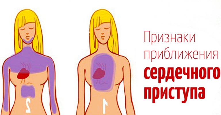 ЗА МЕСЯЦ ДО СЕРДЕЧНОГО ПРИСТУПА ВАШЕ ТЕЛО ПРЕДУПРЕДИТ ВАС ЭТИМИ 9 СИГНАЛАМИ