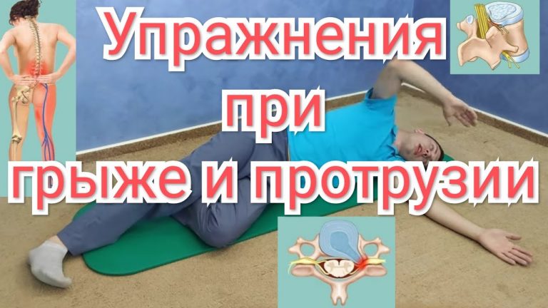Делая ЭТИ упражнения, вы избавитесь от межпозвонковой грыжи БЕЗ ОПЕРАЦИИ