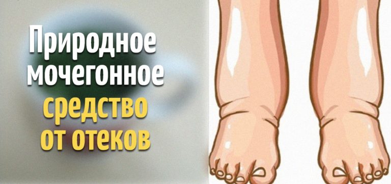Эффективное средство от отека ног