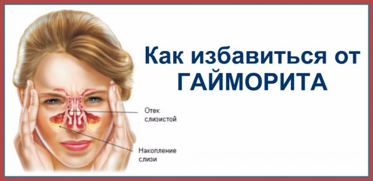 Избавьтесь от гайморита в течение нескольких минут, благодаря ингредиенту, который уже у вас на кухне