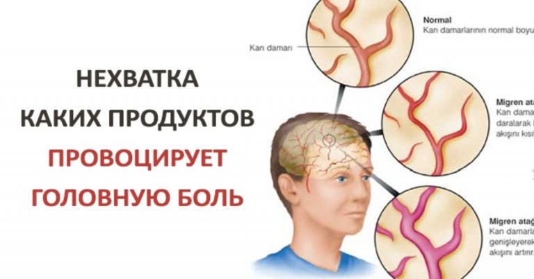 Нехватка этих продуктов вызывает головную боль