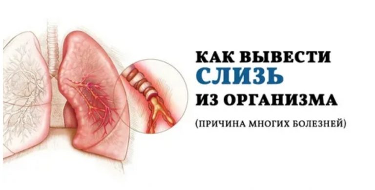 Слизь в организме… Как от нее избавиться