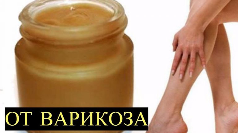 Бабушкин рецепт от варикоза: результаты очень скоро