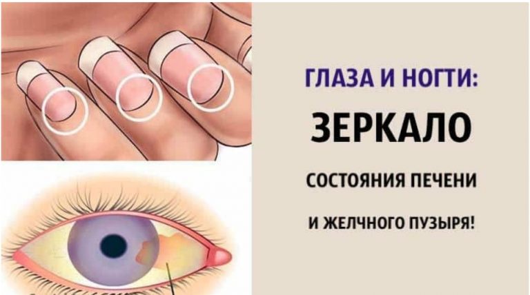 Глаза и ногти: зеркало состояния ПЕЧЕНИ и ЖЕЛЧНОГО ПУЗЫРЯ
