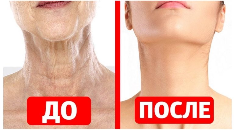 Лучшая маска против дряблой кожи