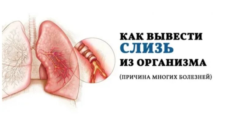 Слизь в организме… Как от нее избавиться
