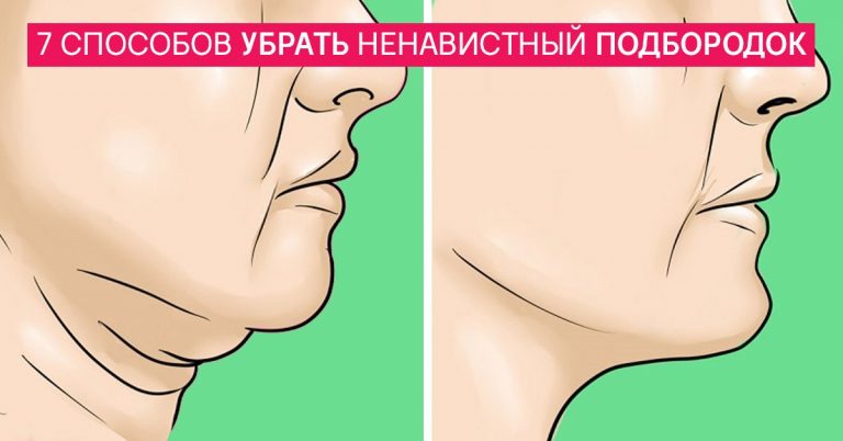 7 способов убрать дряблый двойной подбородок. Минус 10 лет гарантировано