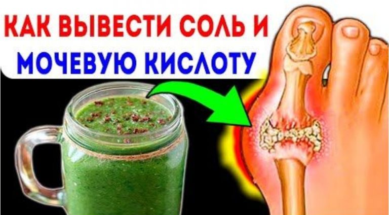 Как этот простой рецепт сока выводит мочевую кислоту из организма
