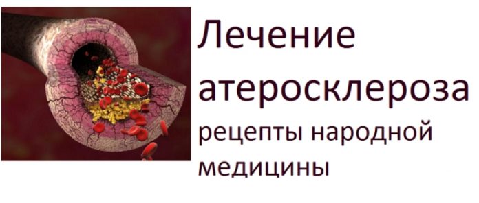 НАРОДНЫЙ РЕЦЕПТ ОТ АТЕРОСКЛЕРОЗА