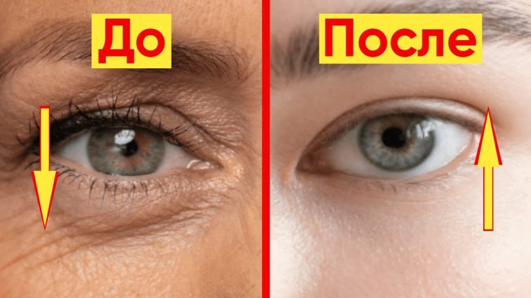 ОТЛИЧНОЕ СРЕДСТВО ПРОТИВ МОРЩИН — РЕЦЕПТ