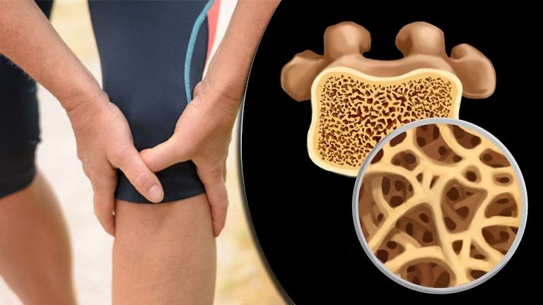 Употребляя эту смесь, вы быстро восстановите структуру ваших костей, суставов и даже зубов