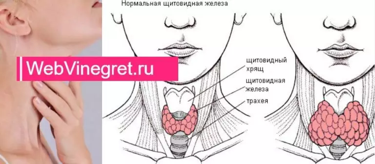 Эта женщина очень устает и постоянно хочет спать. Оказалось, что причина – в горле