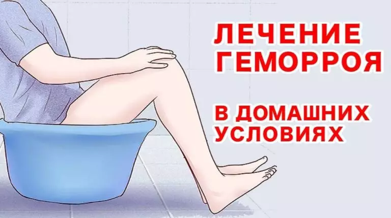 Как вылечить геморрой народными средствами.