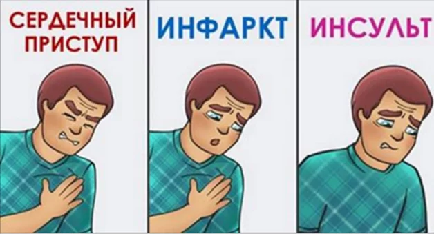 Результат пошуку зображень за запитом "Как различить сердечный приступ, инфаркт и инсульт"