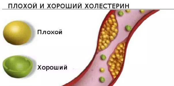Миф о холестерине — крупнейший обман ХХ века