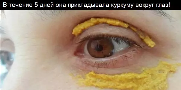 В течение 5 дней она прикладывала куркуму вокруг глаз! И вот что случилось!