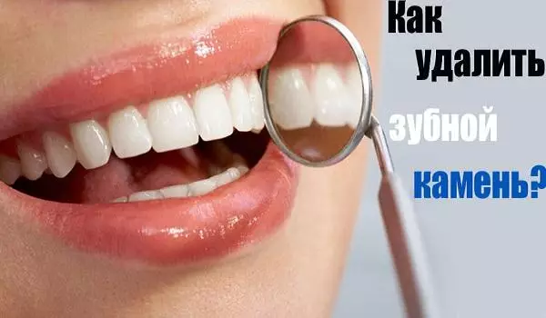 10 простых способов легко удалить зубной камень без визита к зубному врачу!