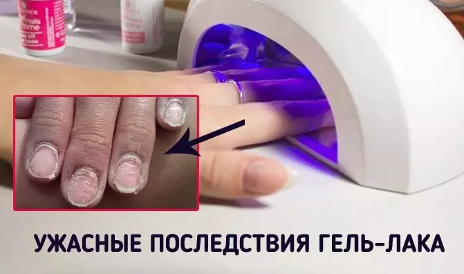 Опасность ГЕЛЬ-ЛАКА! Женщины должны знать об этом!