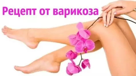 Избавься от варикозного расширения вен и сосудистых звёздочек навсегда! Используй 1 простой ингредиент!