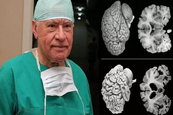 Неврологи бьют тревогу! Всем женщинам нужно прислушаться к этому совету