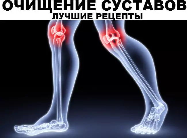Лучшие рецепты для очищения суставов