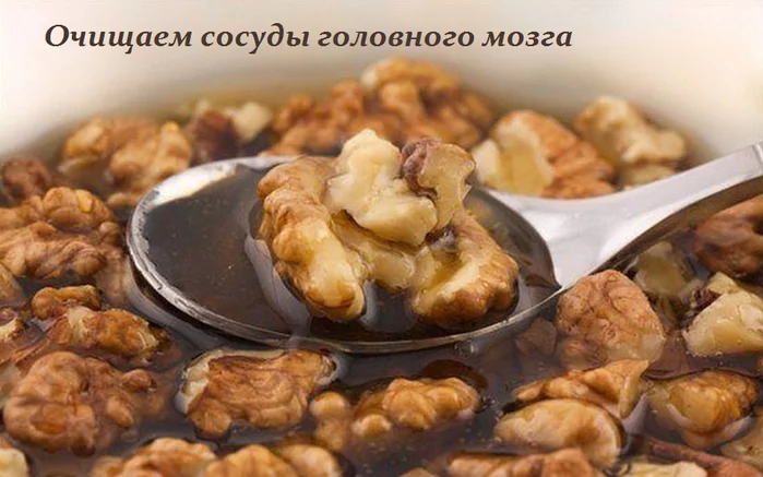 ОЧИЩАЕМ СОСУДЫ ГОЛОВНОГО МОЗГА