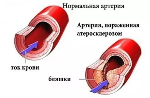 УКРОП + МЁД + ВАЛЕРИАНА = ЧИСТЫЕ СОСУДЫ