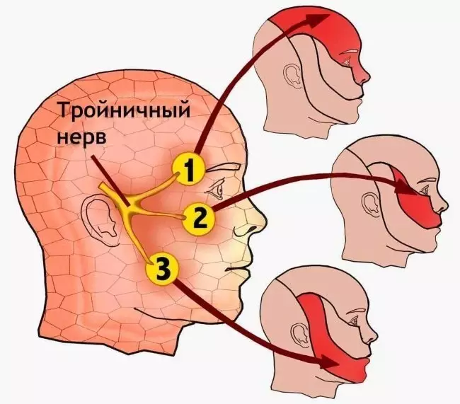 ЗАБУДЕТЕ ПРО ГАЙМОРИТ И ПРОБЛЕМЫ ТРОЙНИЧНОГО НЕРВА — БЕЗ ЛЕКАРСТВ