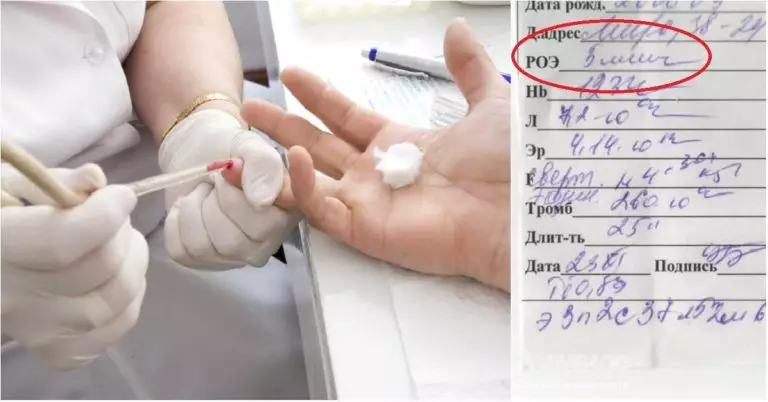 9 показателей крови, которые расскажут всё о здоровье: читай анализ правильно!