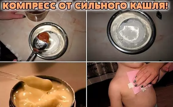 Эффективный компресс от сильного кашля! Лечит за вечер