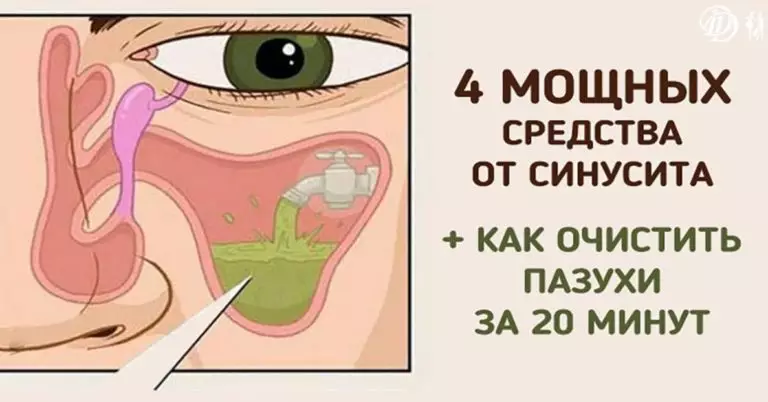 Если вас замучил насморк, попробуйте эти 4 мощных средства!