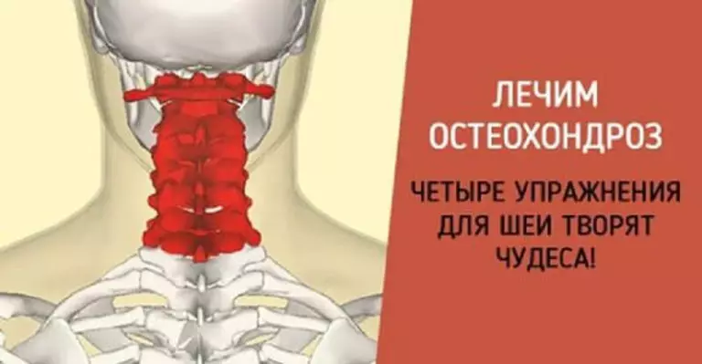 Гимнастика для шеи — четыре шага к гибкости и красоте!