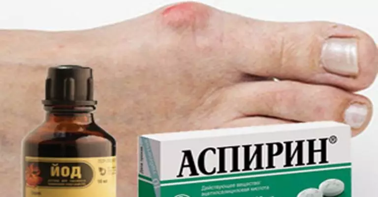 Эти народные способы быстро уберут косточку на ноге. Большая шишка на ноге растает за неделю!