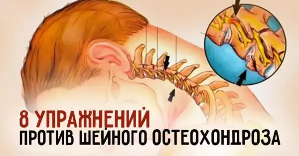 8 потрясающих упражнений от шейного остеохондроза. Сделай шаг к здоровью!
