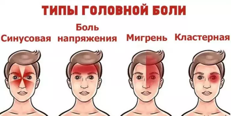 4 вида головной боли. Вот как правильно избавиться от каждой из них