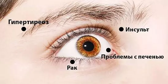 8 Сигналов, При Помощи Которых Глаза Предупреждают О Проблемах Со Здоровьем. Обрати Внимание