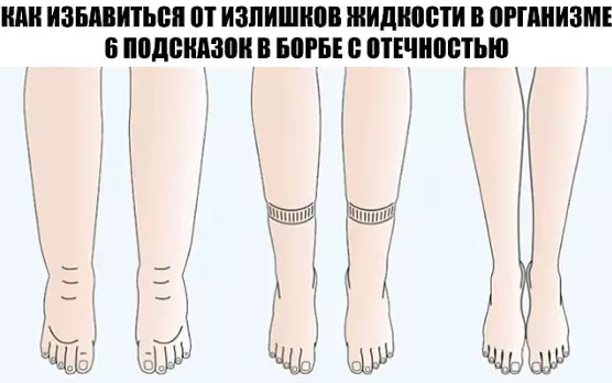КАК ИЗБАВИТЬСЯ ОТ ИЗЛИШКОВ ЖИДКОСТИ В ОРГАНИЗМЕ: 6 ПОДСКАЗОК В БОРЬБЕ С ОТЕЧНОСТЬЮ