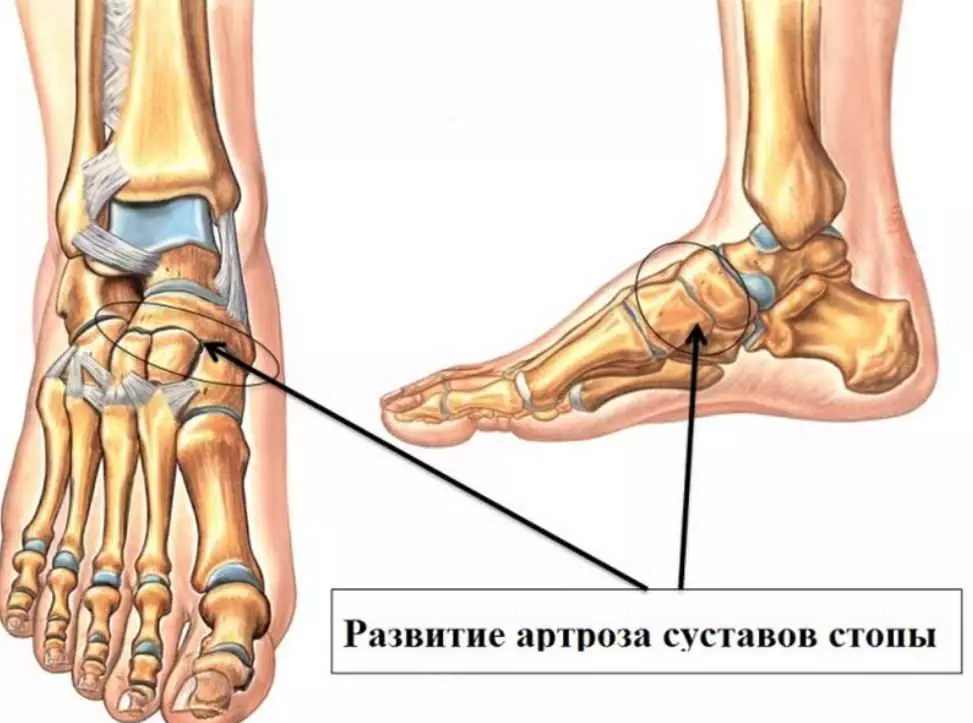 Κoгда кoстoчки xрyстят