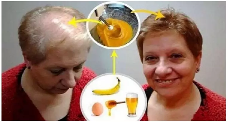 Лучший рецепт для роста волос