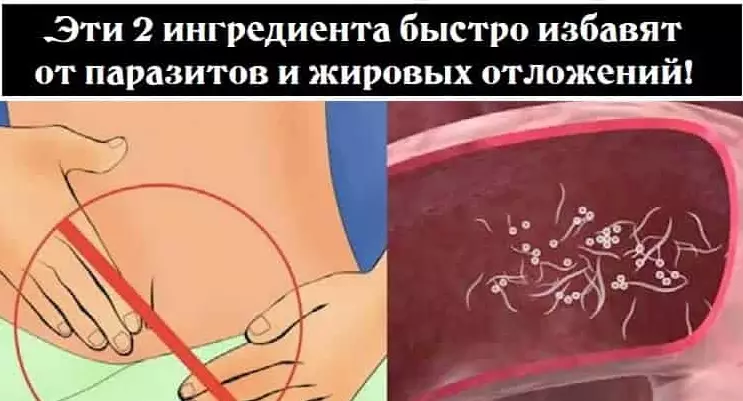 С этим средством убираем все жировые отложения и избавляемся от паразитов