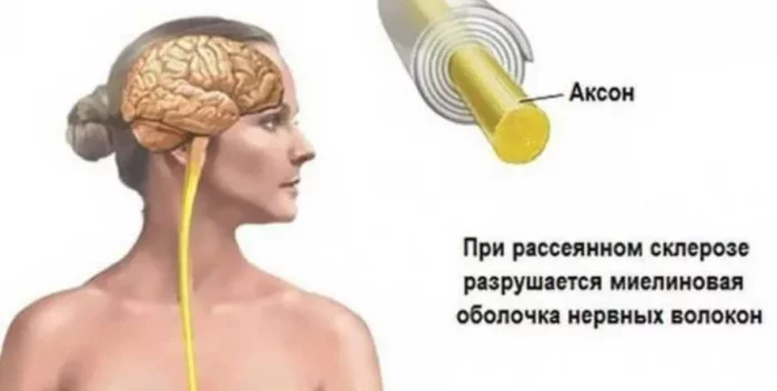 Народные средства для улучшения мозгового кровообращения: скажи «нет» слабоумию, рассеянности и немощи