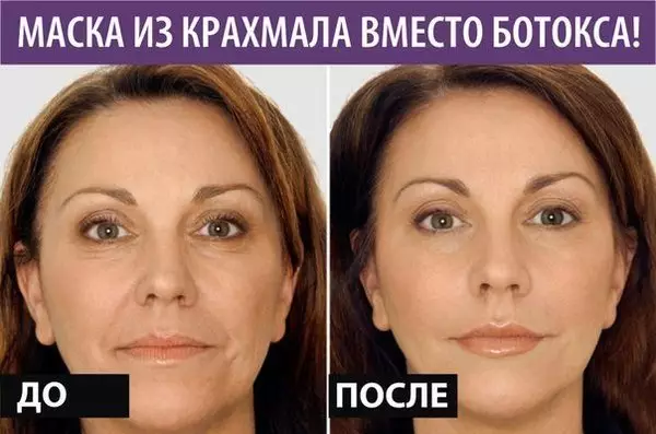 Не думайте о ботоксе — обычный крахмал избавит от морщин