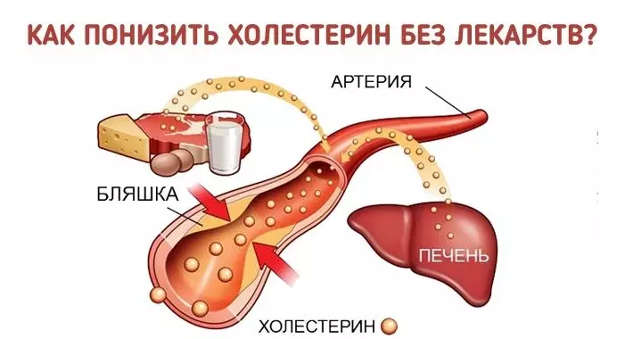 Как понизить уровень холестерина БЕЗ лекарств