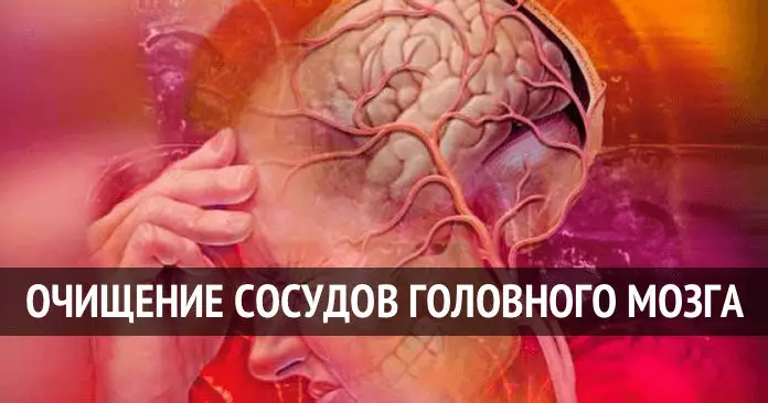ТОП- 5 народных рецептов для очищения сосудов головного мозга