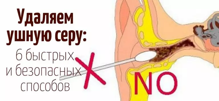Как правильно чистить уши в домашних условиях
