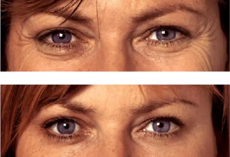 КАК СТАТЬ МОЛОЖЕ ЗА 5 МИНУТ: ЭТА МАСКА С ЭФФЕКТОМ ЛИФТИНГА УТРЕТ НОС ПЛАСТИЧЕСКОЙ ХИРУРГИИ